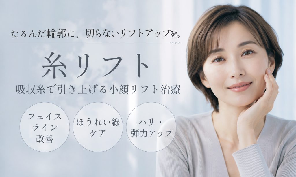 糸リフト