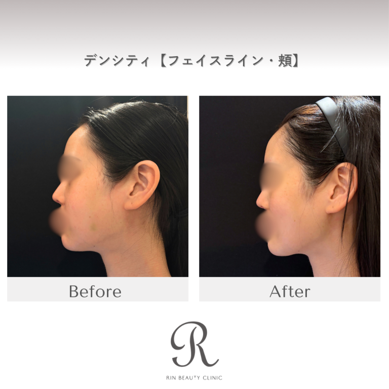 診療前後の症例写真