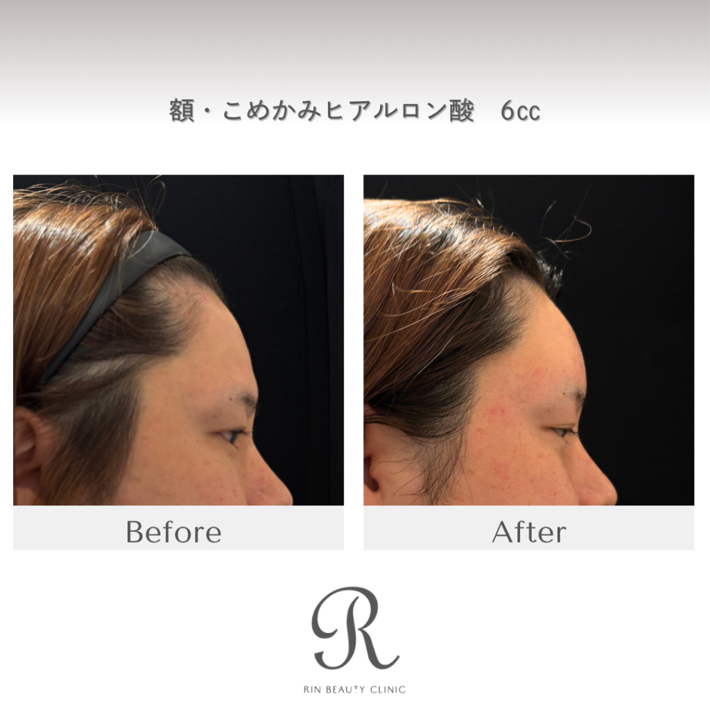 診療前後の症例写真