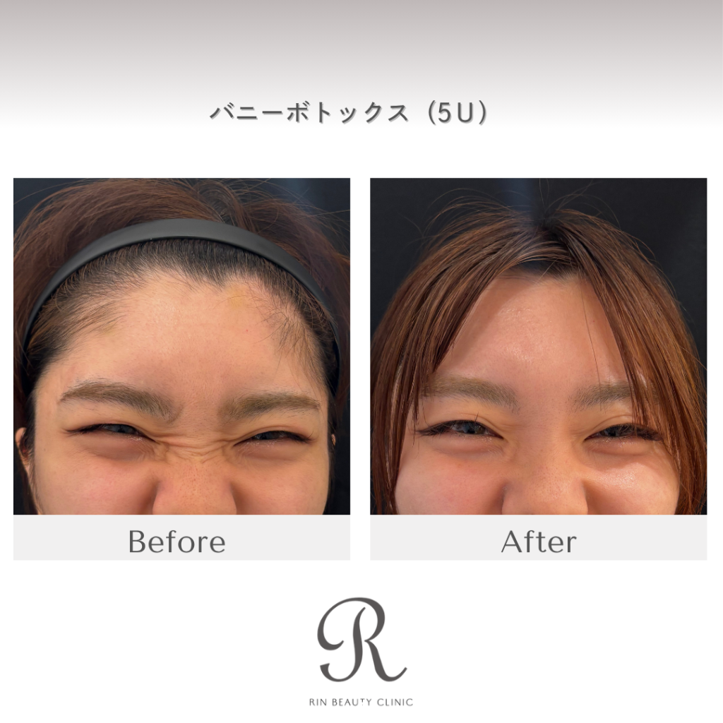 診療前後の症例写真