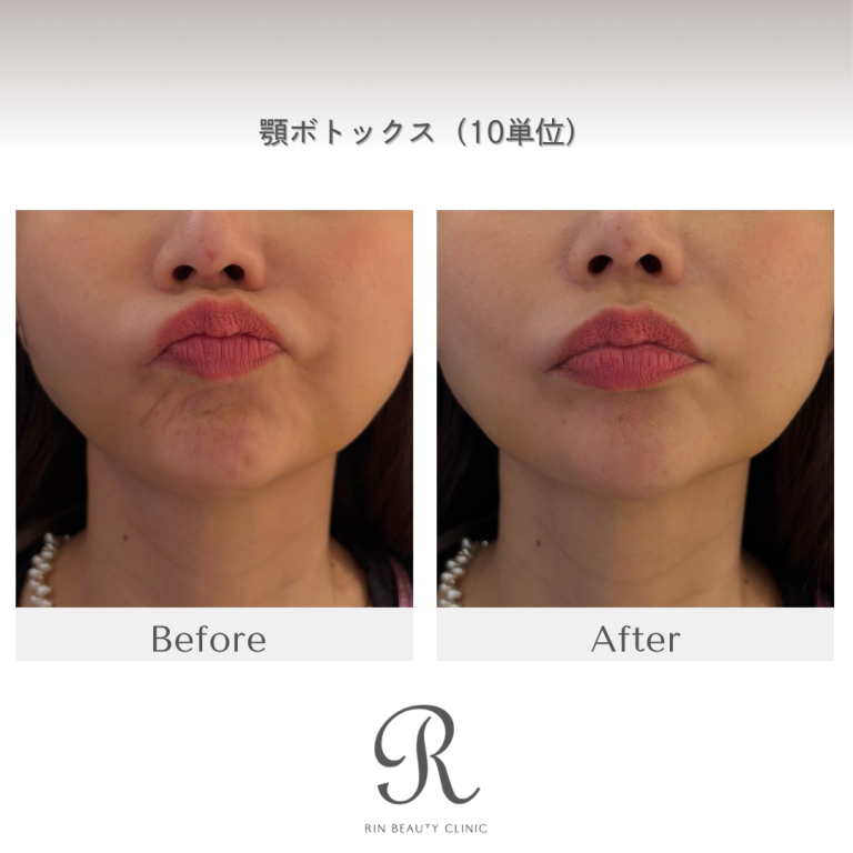 診療前後の症例写真