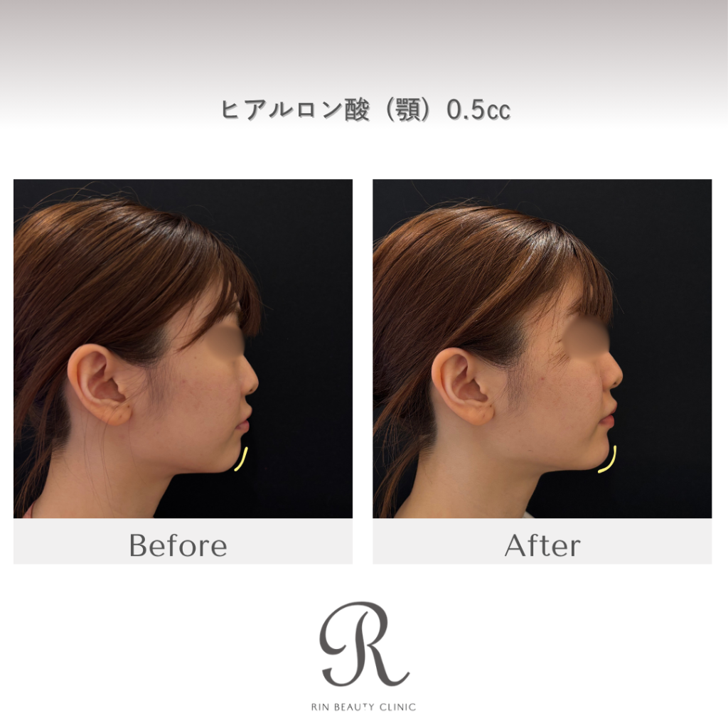 診療前後の症例写真