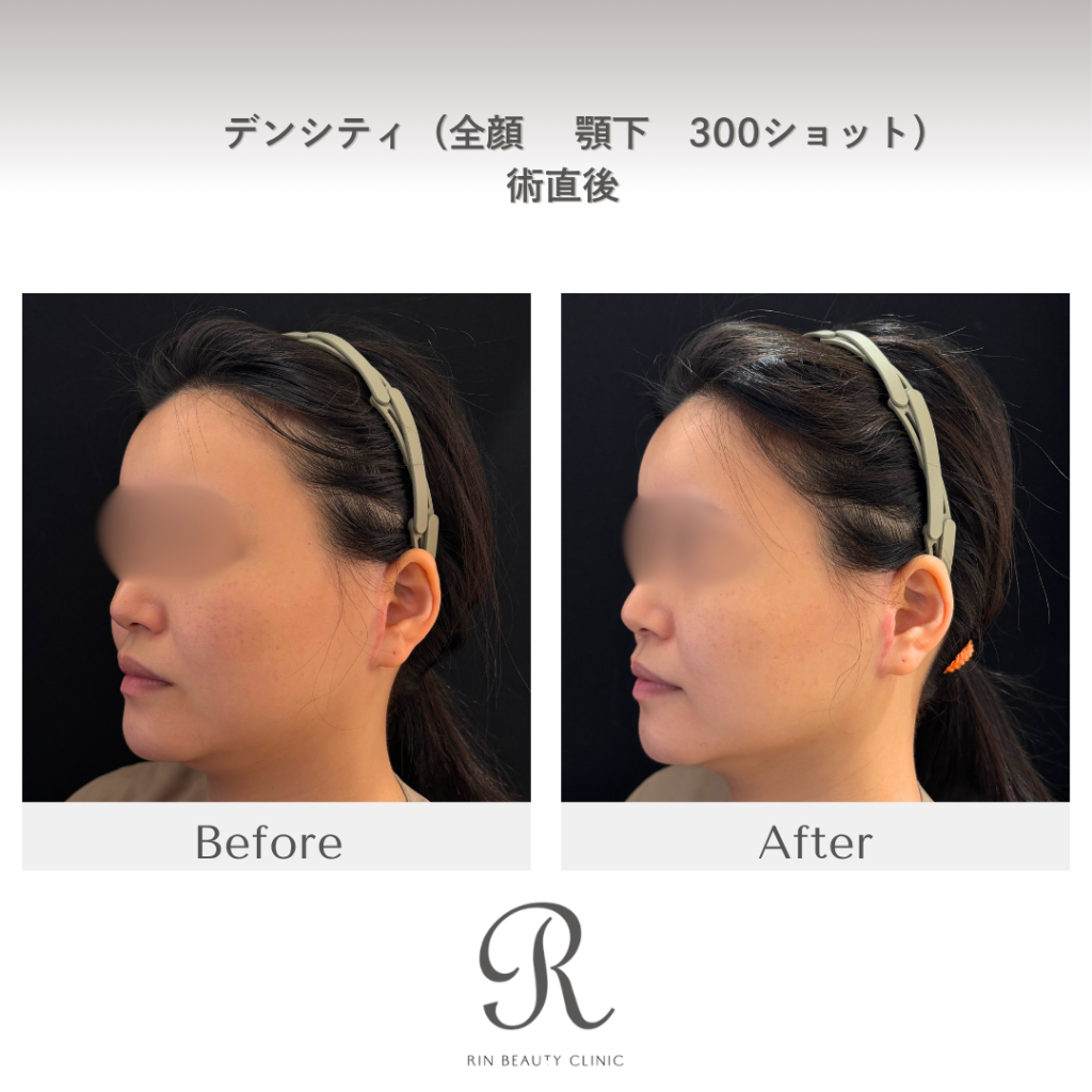 診療前後の症例写真