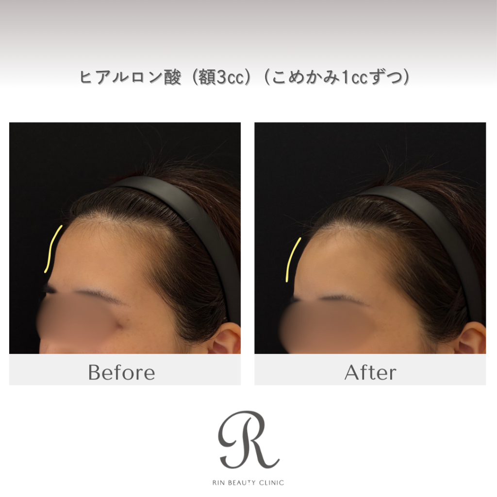 診療前後の症例写真