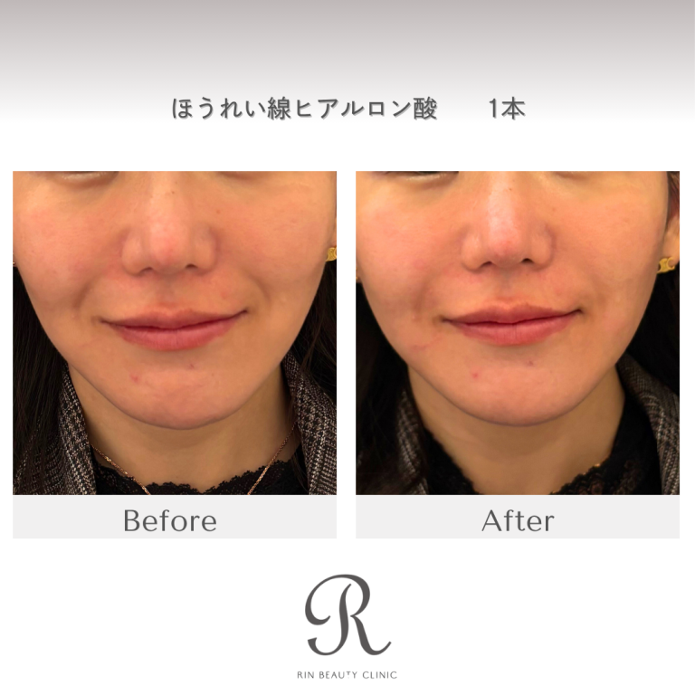 診療前後の症例写真