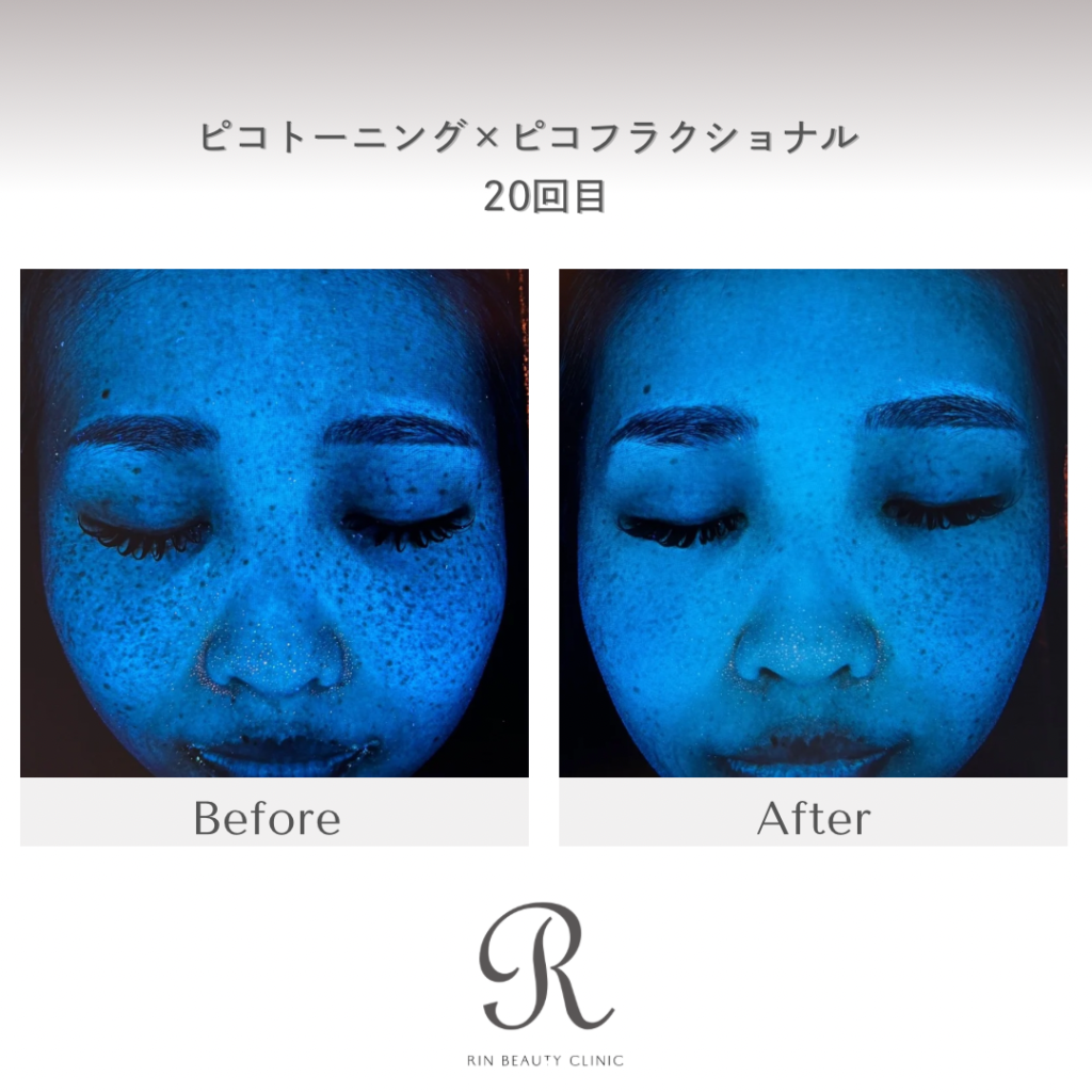 診療前後の症例写真