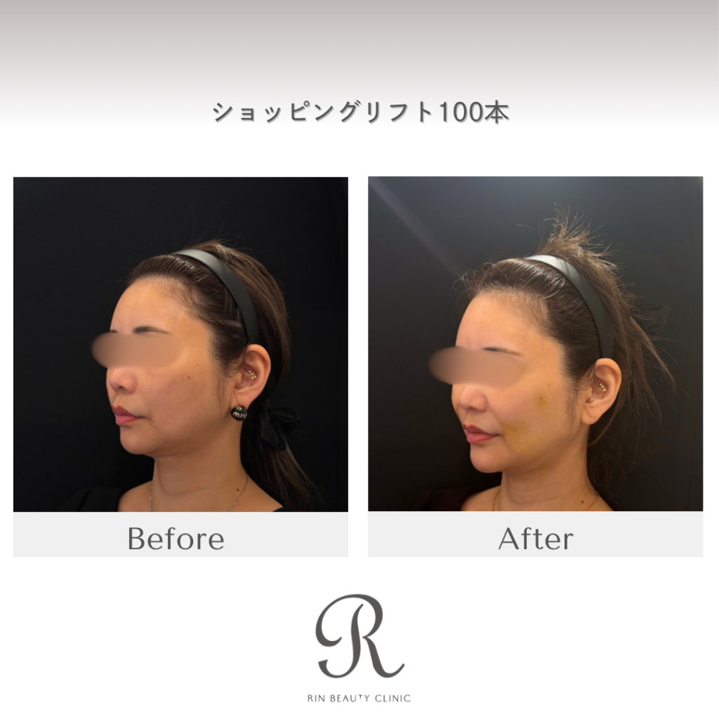 診療前後の症例写真