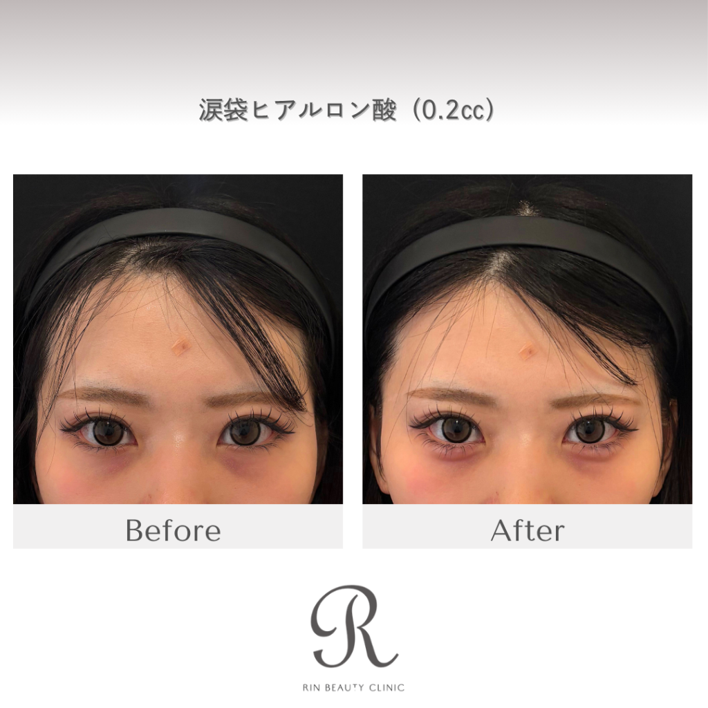 診療前後の症例写真