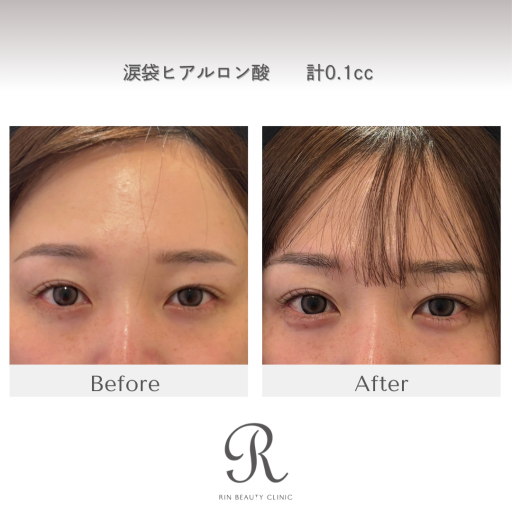 診療前後の症例写真