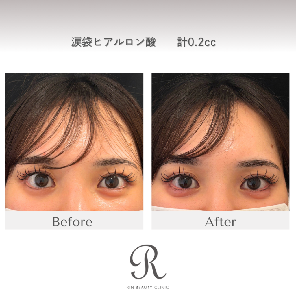 診療前後の症例写真