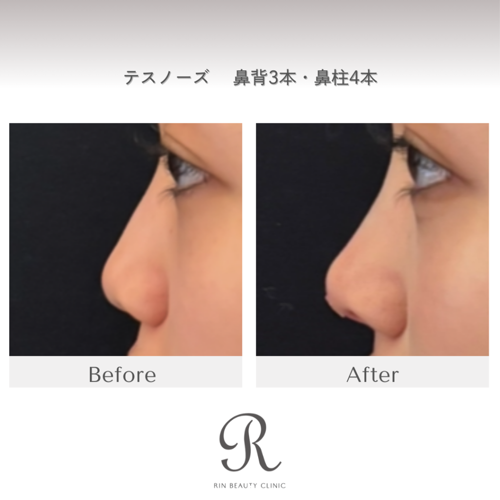 診療前後の症例写真