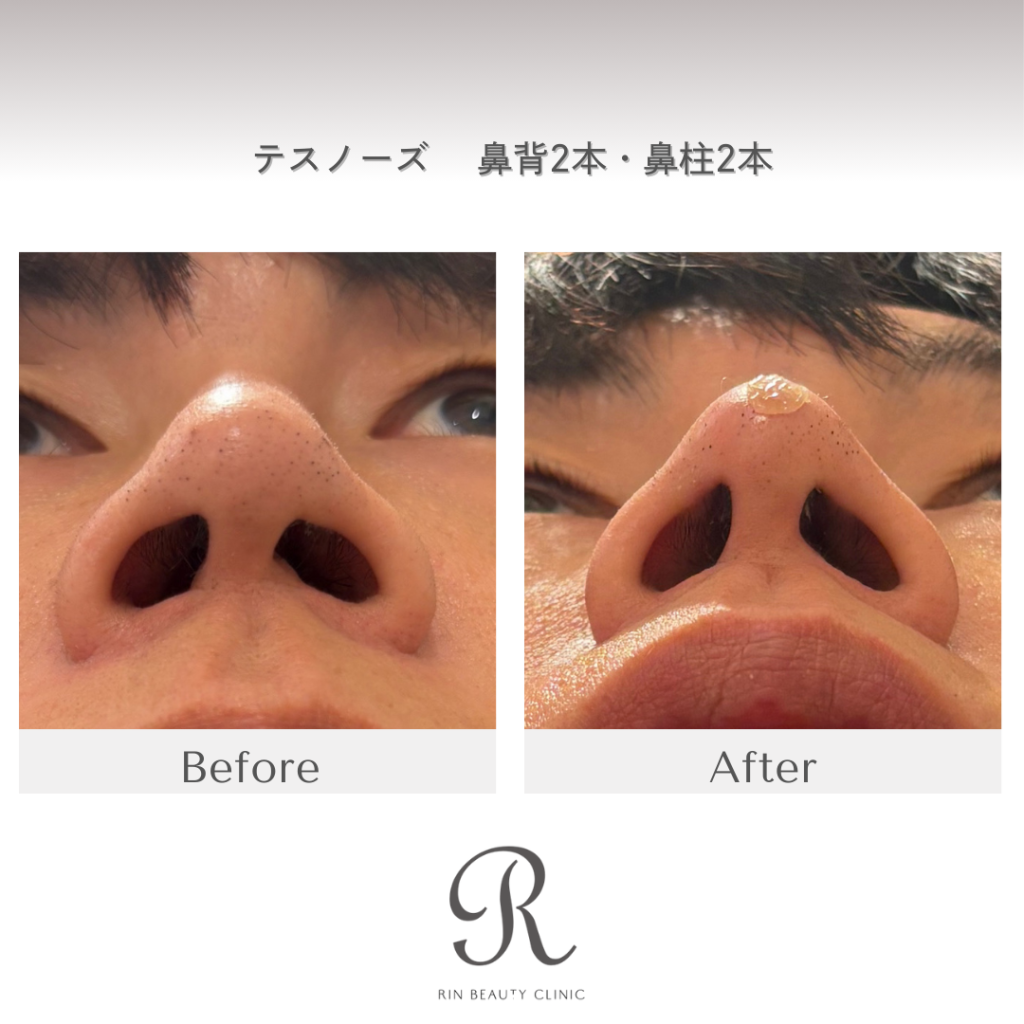 診療前後の症例写真
