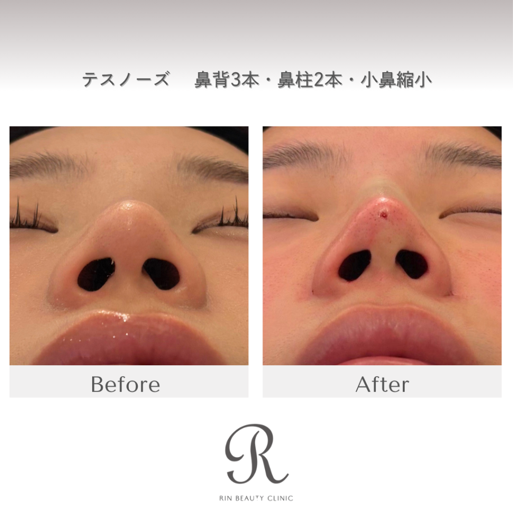 診療前後の症例写真
