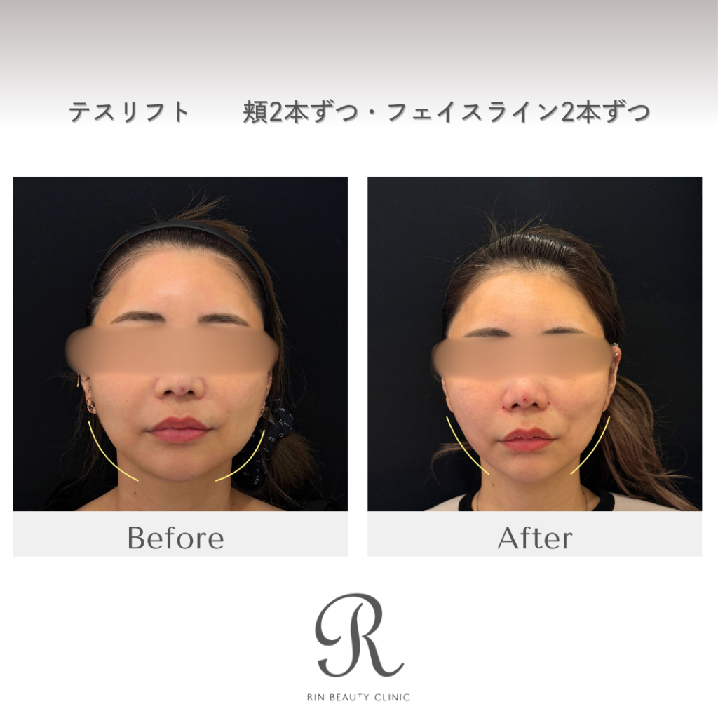 診療前後の症例写真