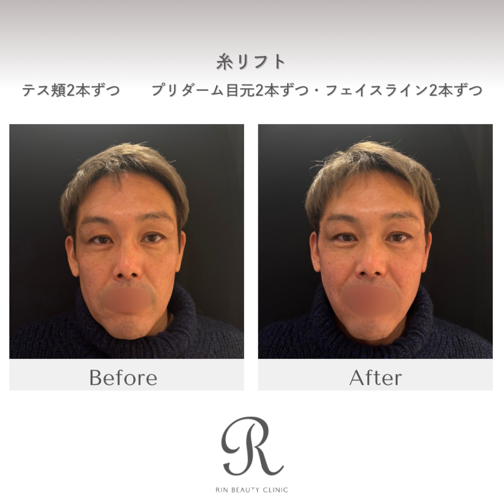 診療前後の症例写真