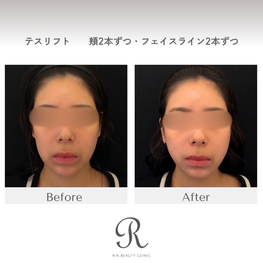 診療前後の症例写真