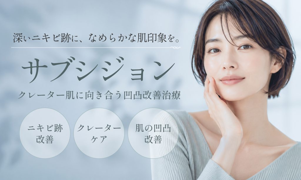 サブシジョン