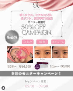 施術料金50％OFF！！　　　　　　　　　　　　　　ボトックス・ヒアルロン酸・糸リフト・肌育治療・シミ取り等 各施術モニターキャンペーン情報！