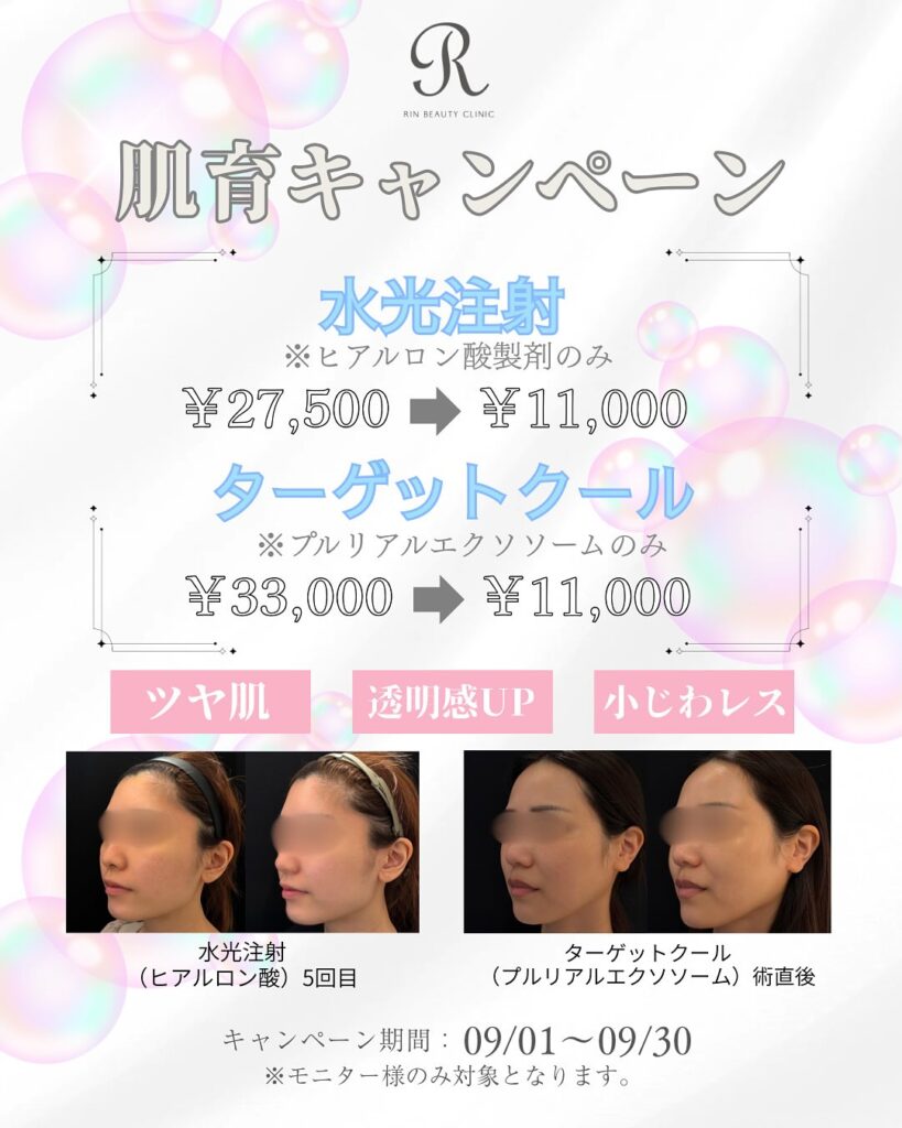 心斎橋の肌育治療のモニター募集のバナー