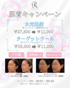 1万円お試しキャンペーン！　　　　　　　　　　　　　　　人気のターゲットクール、水光注射で夏の疲れた肌に潤いを！　　　　　　　　　　　　　　