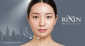 くすみに悩む全ての人へ｜心斎橋RIN BEAUTY CLINICの美白哲学が変える肌の未来