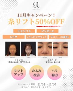 大阪心斎橋の美容皮膚科の糸リフトの2025年11月のキャンペーン