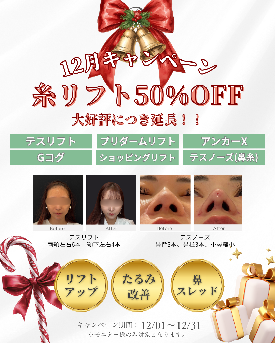 ◆キャンペーン内容 糸リフト　プリダームテスリフト　テスリフト　アンカーX　Gコグリフト　ショッピングリフト 鼻スレッド　テスノーズ　Gコグノーズメッシュ