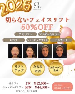 モニター半額2026年1月新春キャンペーン！切らないフェイスリフト、カスタマイズ肌施術！！　　　　　　　　　　　　　