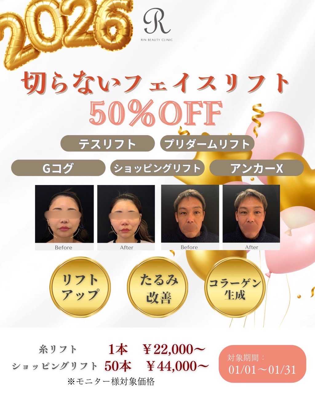 切らないフェイスリフト、カスタマイズ肌治療