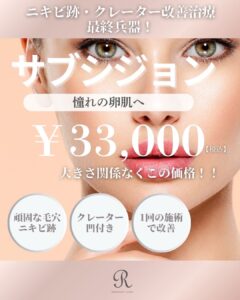 モニターキャンペーン！　　　　　　　　　　　　ニキビ跡・クレーター改善！サブシジョン！！　　　　　　　　　　　　　　　　　　　切らずにパッチリ二重！二重埋没法！！